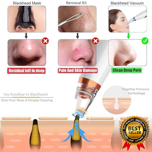 Careit™ Blackhead & whitehead Remover Tool