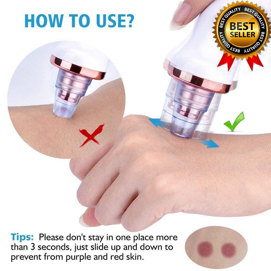 Careit™ Blackhead & whitehead Remover Tool